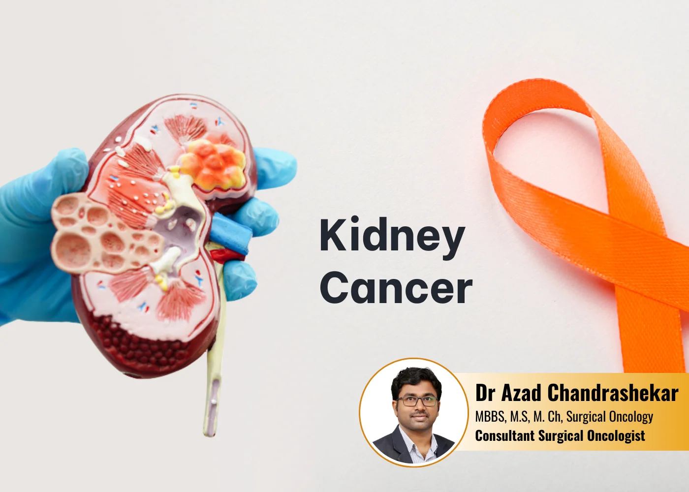 Best Kidney-Cancer treatment in Hyderabad
